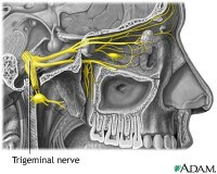 trigeminal-eyes-e1405630588332