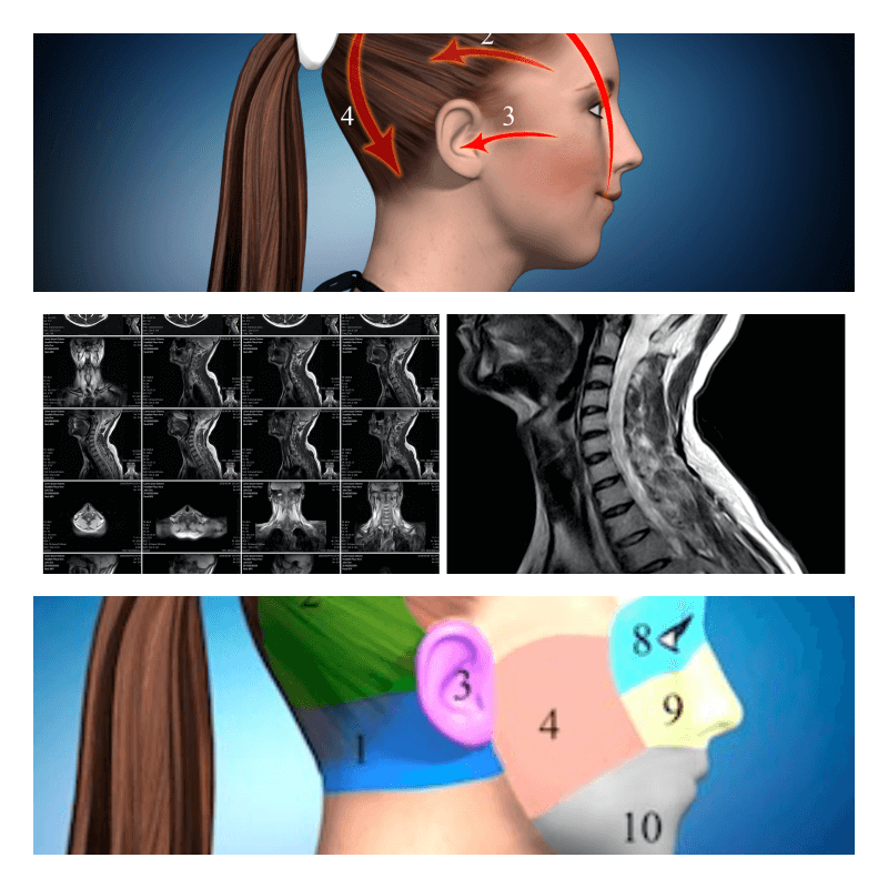tmc-photo-of-symptoms-collage-a