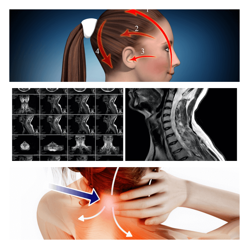 tmc-photo-of-symptoms-complications-2a